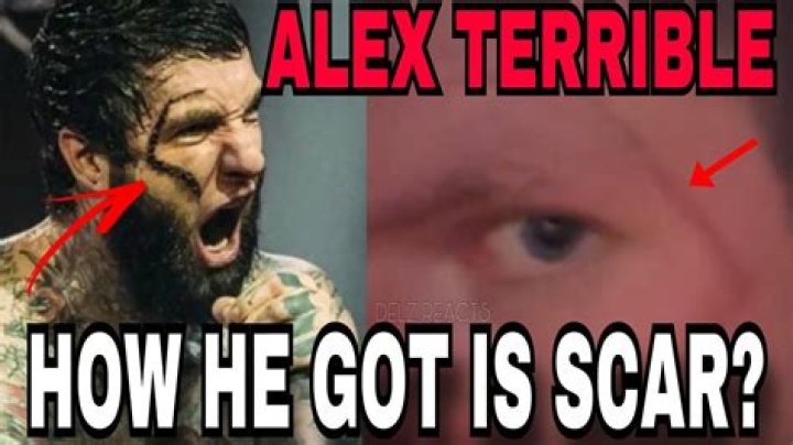 Discoveries And Insights Into "Alex Terrible Facial Scar"
