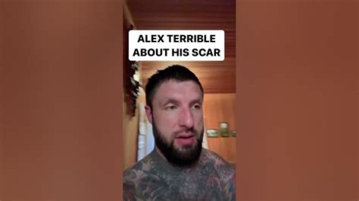 Unveil The Enigmatic Secrets Of "Alex The Terrible Scar"
