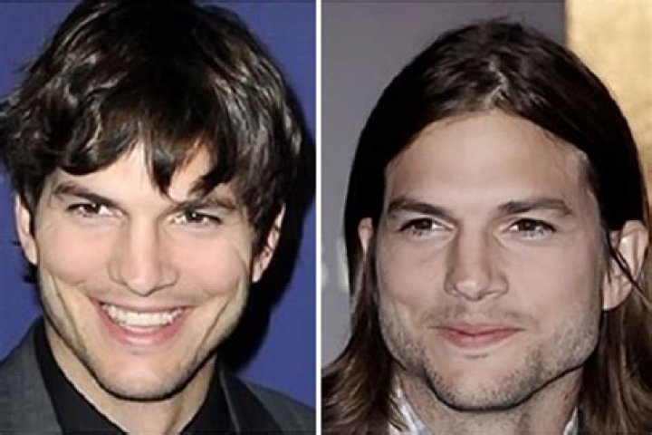 Uncover Aston Kutcher's Jaw Implant: Discoveries And Insights