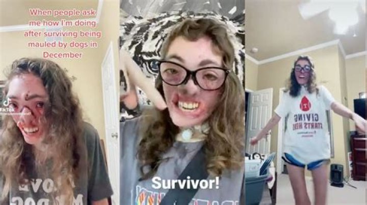 Unveiling The Jacqueline Dog Attack: Insights And Revelations