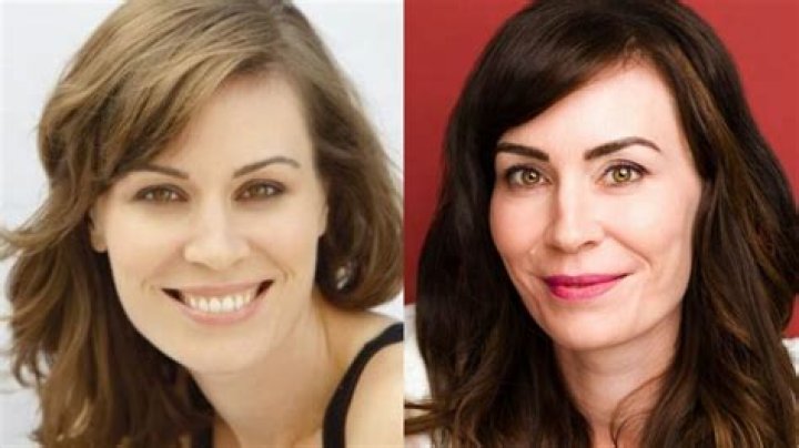 Unlocking The Secrets Of Jan Toyota Plastic Surgery: Unveil Exceptional Results