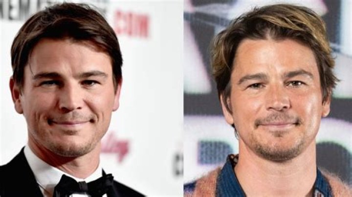 Josh Hartnett Plastic Surgery