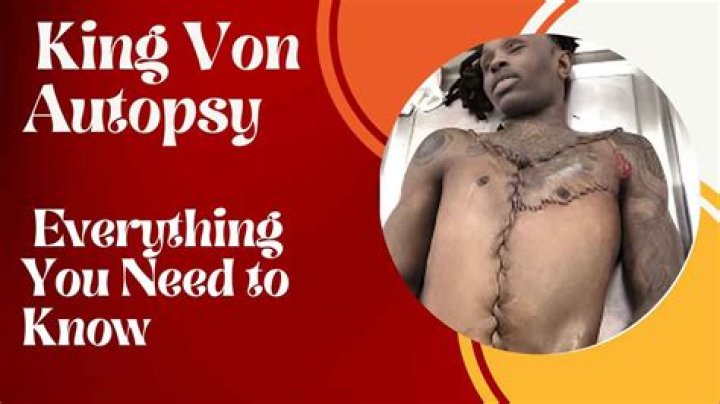 King Von Autopsy Unravels Mysteries