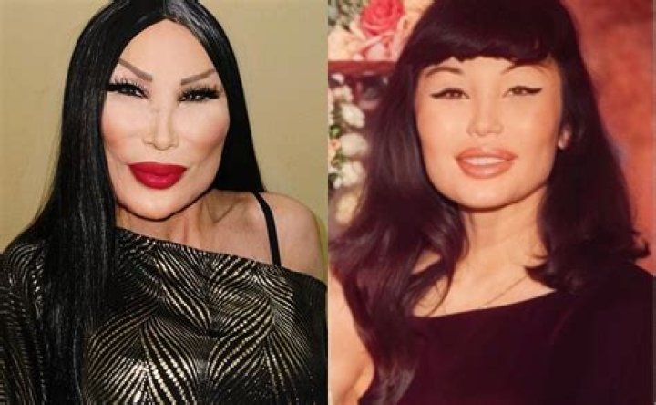 Unveiling The Secrets Of Mexican Actress Plastic Surgery: Discoveries And Insights