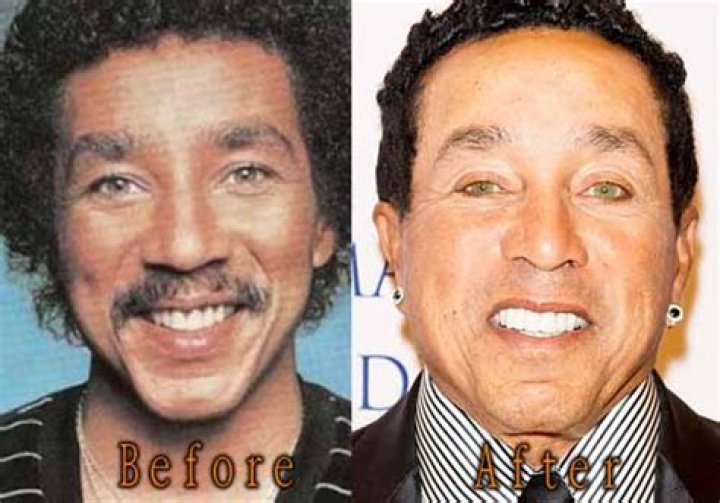 Smokey Robinson's Plastic Surgery Journey: Uncovering The Secrets