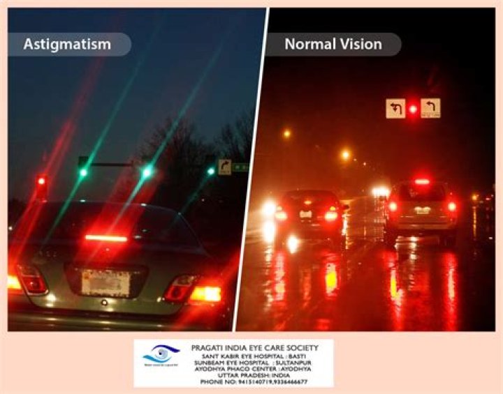 Unveiling The Enigma: Stigmatism Vs AstigmatismIlluminating Insights