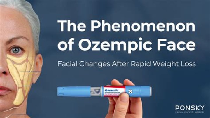 Discover The Ultimate Remedies For Ozempic-Induced Nausea